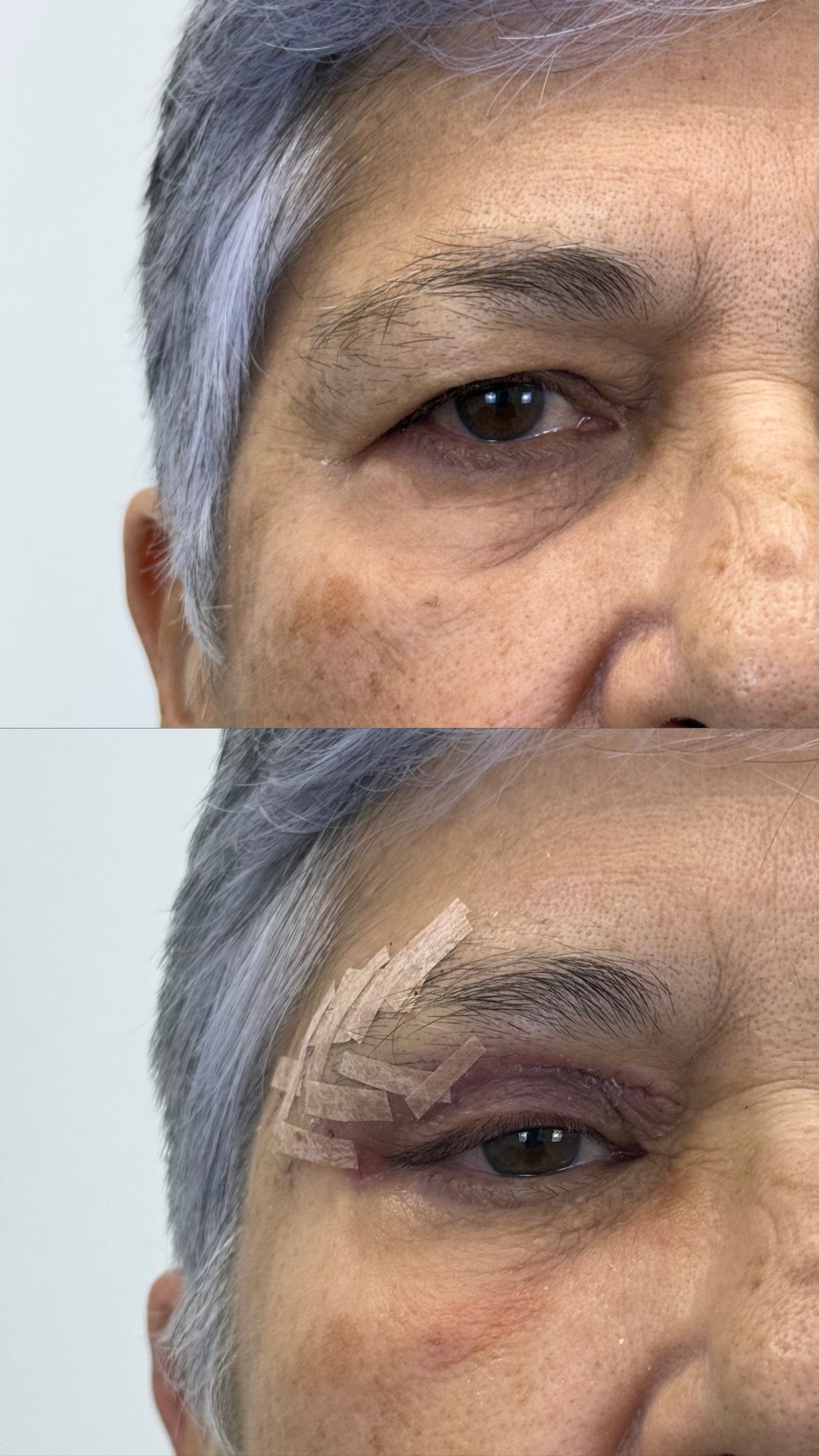 Antes y después