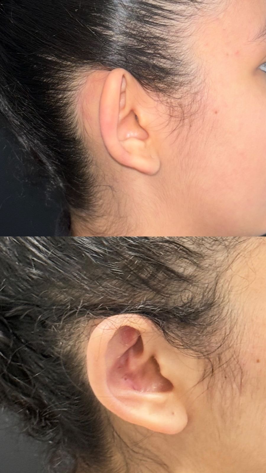 Antes y después