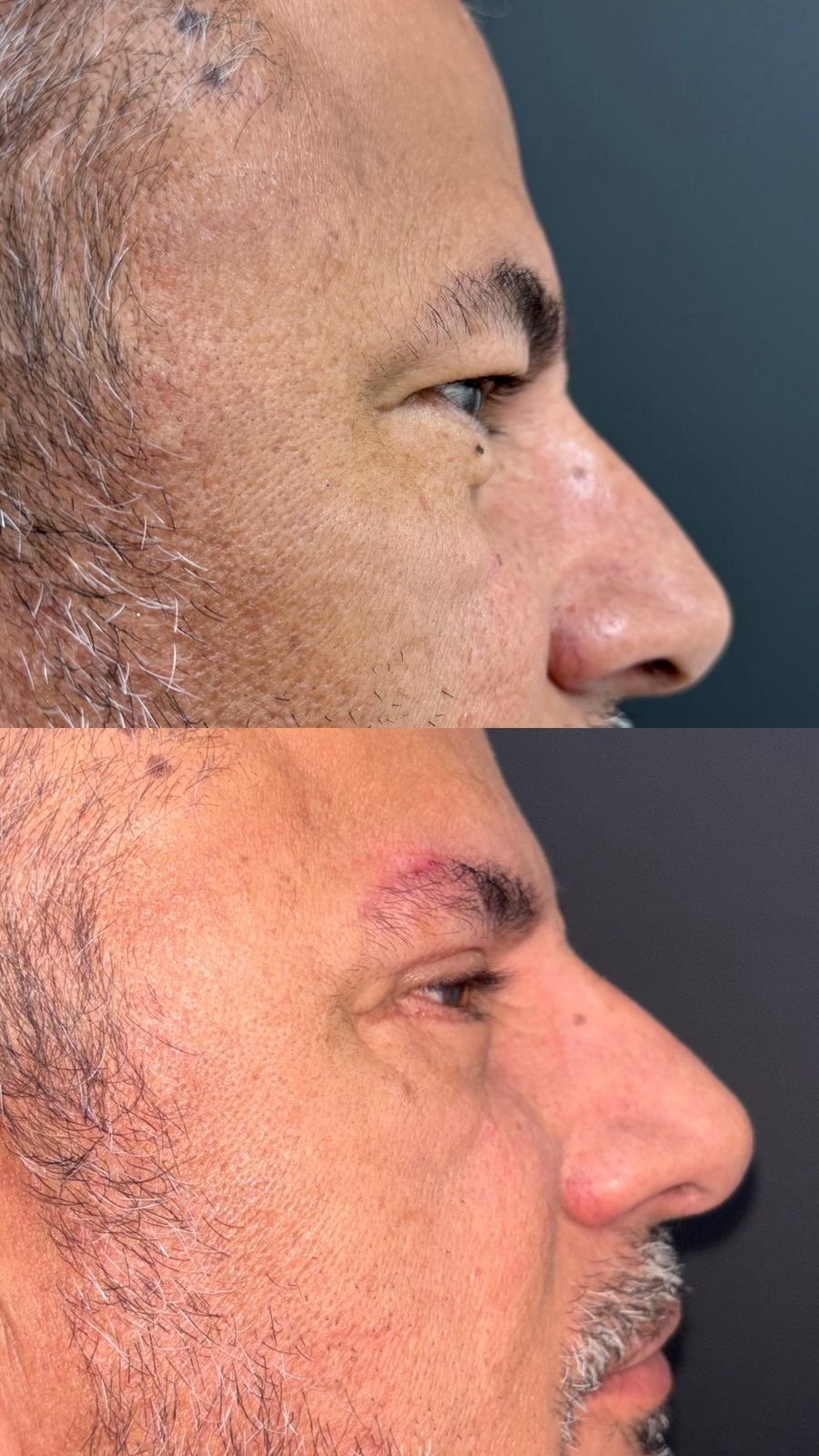 Antes y después