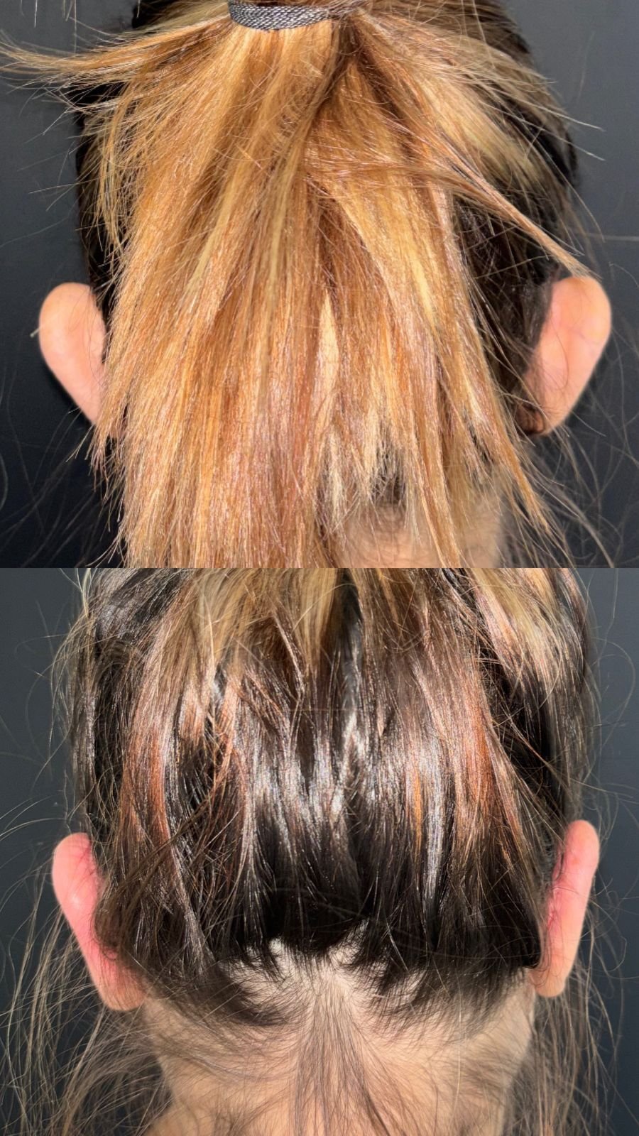 Antes y después