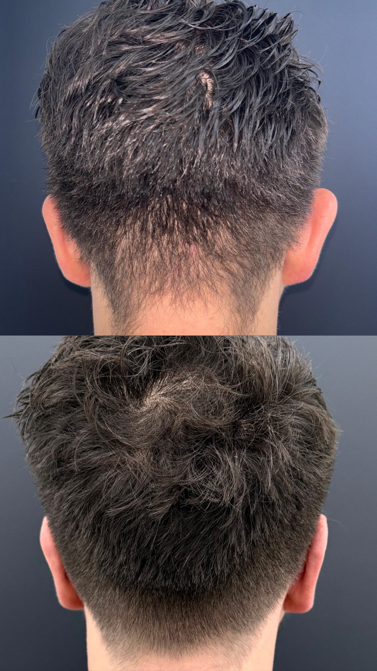 Antes y después